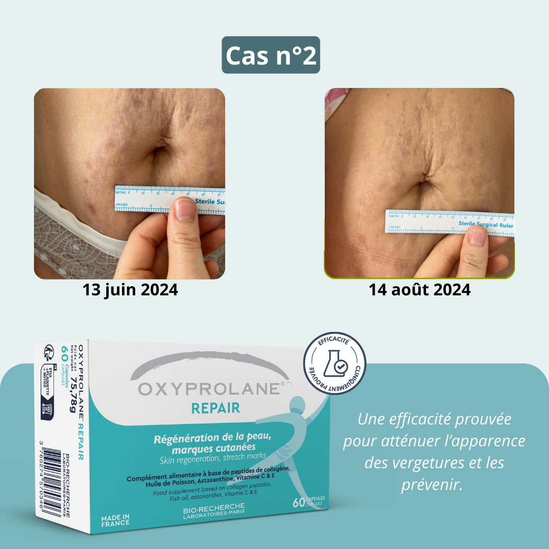 Oxyprolane® Repair – Régénération de la peau, vergetures – Image 6